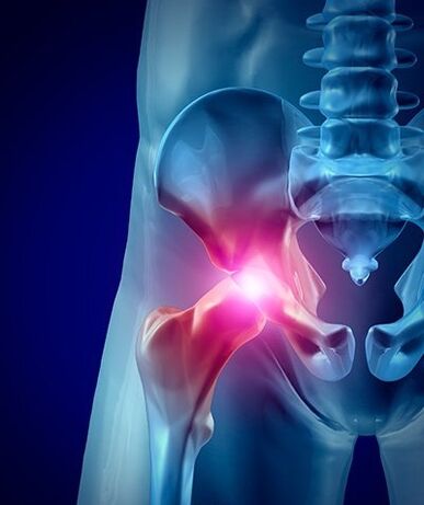 dolore all'anca foto 1